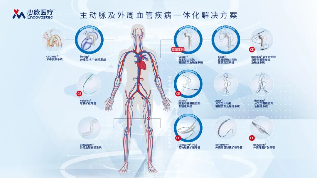 心脉医疗，心血管介入医疗器械领域的佼佼者